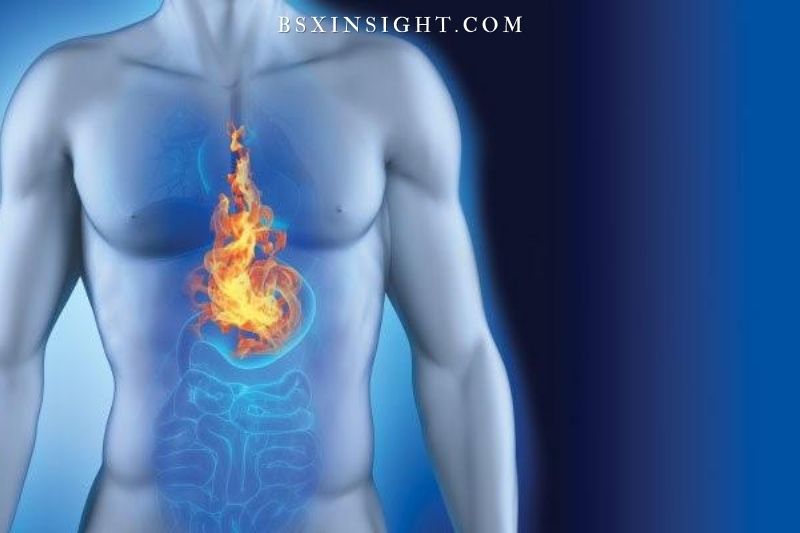 Acid Reflux and Digestion