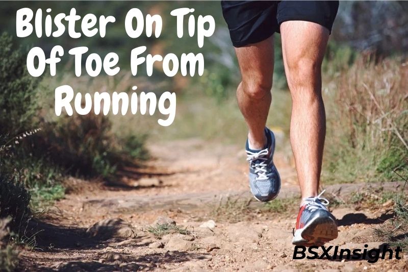 Blister On Tip Of Toe From Running Find Out Cause And Prevention